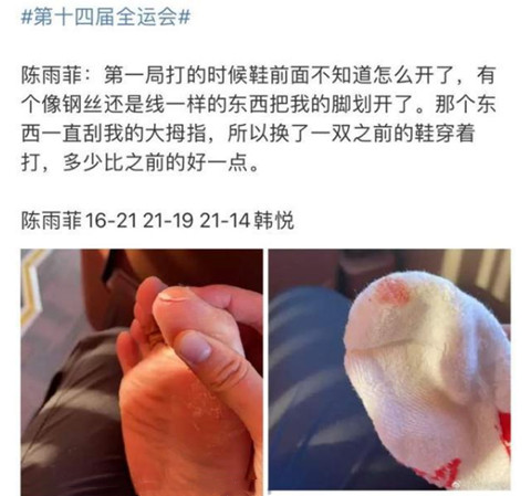 陈雨菲穿李宁鞋比赛脚被割伤，运动员保险保障哪些内容?